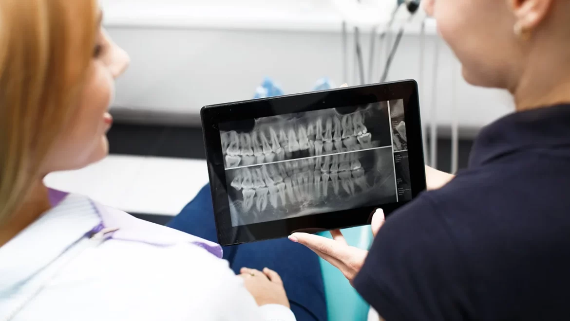dental implants 01