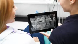 dental implants 01