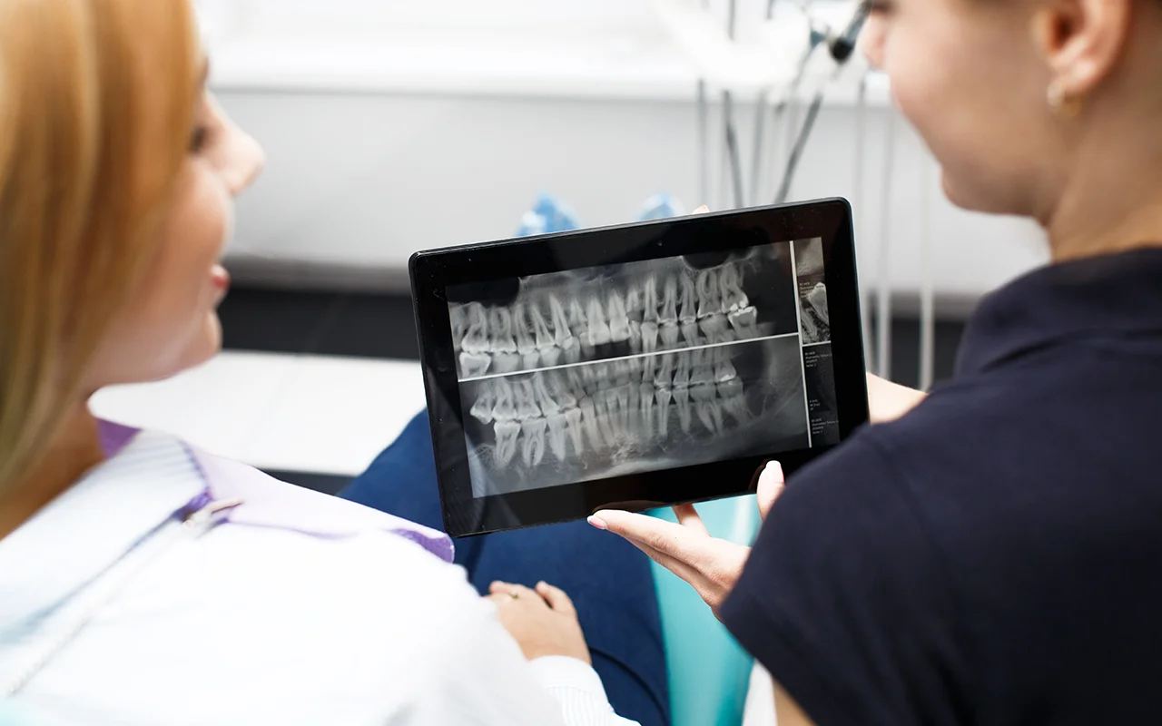 dental implants 01