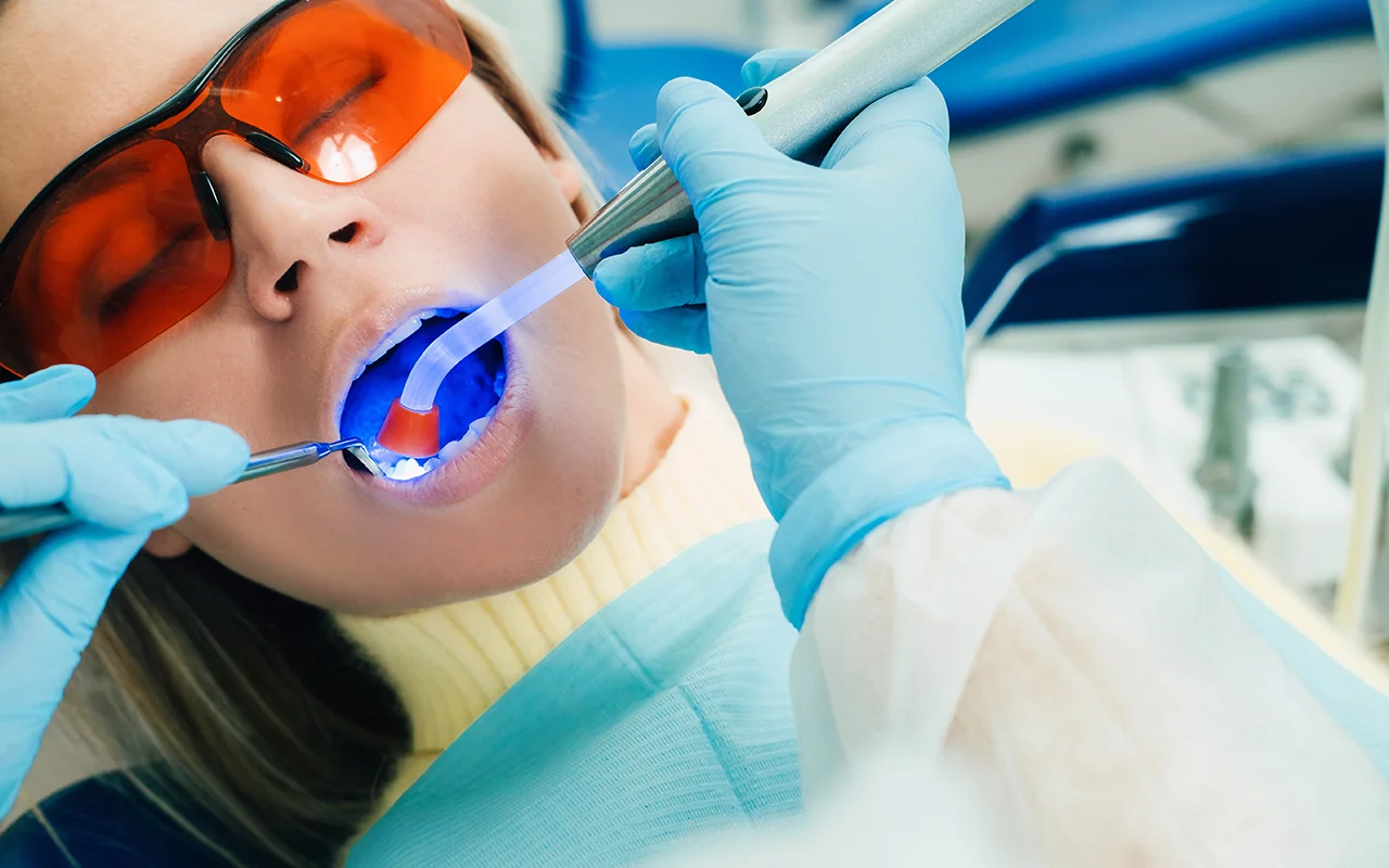 branqueamento dentario tratamento